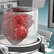 3D打印人体器官