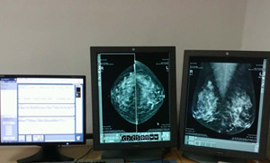 新型医疗X光乳腺成像法 辐射低出25倍