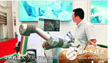 骨科手术机器人天玑在安徽医科大学成功完成
