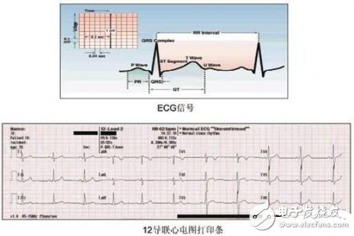 利用ECG AFE简化病人监护仪设计