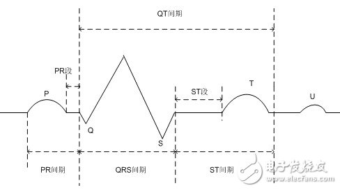 图1.1 标准心电信号的波形组成