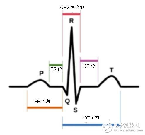 图一：心电图中的 P-QRS-T波