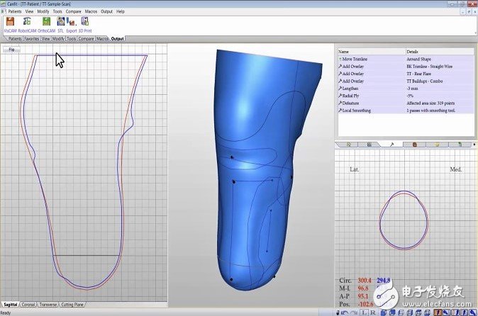 3D打印可帮助医生设计并定制出医疗设备