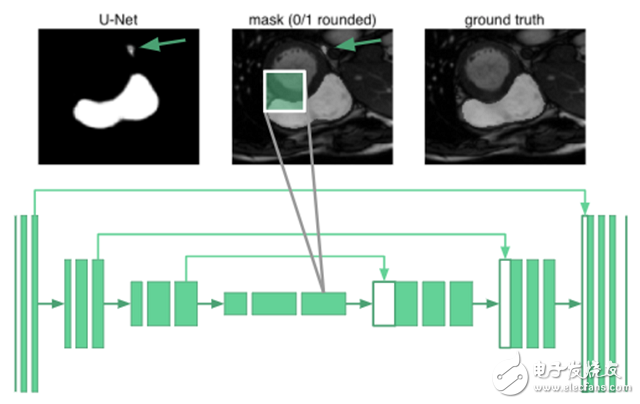 深度学习如何进行MRI图像右心室分割